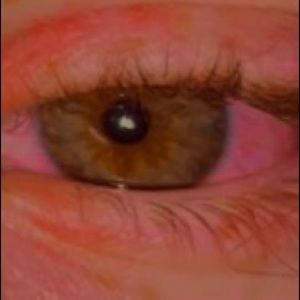 Meet your Posher, Ross